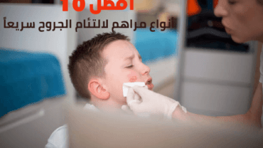 أفضل 10 أنواع مرهم لالتئام الجروح سريعاً