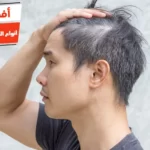 أفضل 10 أنواع الصبغات للشعر الأبيض للرجال