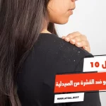 أفضل 10 أنواع شامبو ضد القشرة من الصيدلية