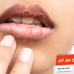 أفضل 10 أنواع كريم تفتيح حول الفم