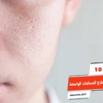 أفضل 10 أنواع كريم لعلاج المسامات الواسعة