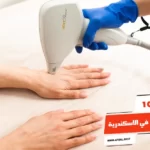 أفضل 10 عيادات ليزر في الاسكندرية