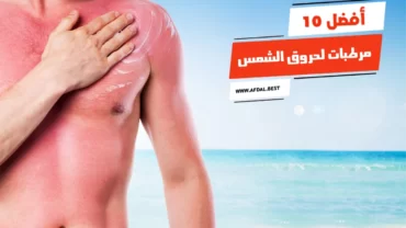 أفضل 10 مرطبات لحروق الشمس