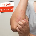 أفضل 10 أنواع مرهم لعلاج الحزام الناري