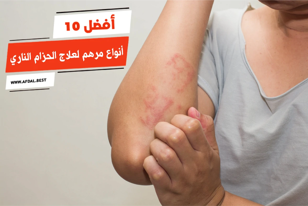 أفضل 10 أنواع مرهم لعلاج الحزام الناري