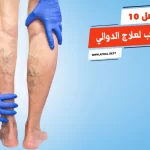 أفضل 10 حبوب لعلاج الدوالي