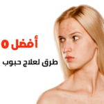 أفضل 10 طرق لعلاج حبوب الجبهة