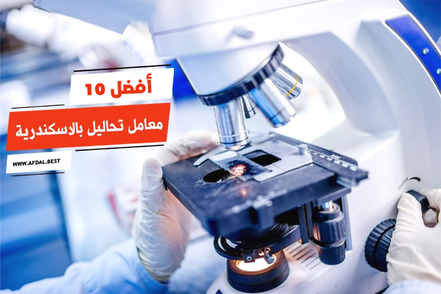 أفضل 10 معامل تحاليل بالاسكندرية