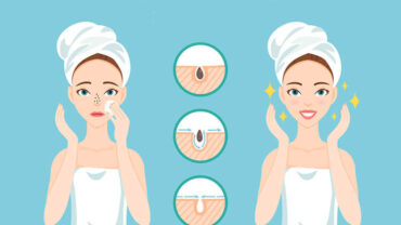 تقليل ظهور الرؤوس السوداء