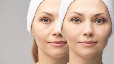 حماية البشرة من التجاعيد وعلامات الشيخوخة