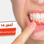 أفضل 10 أدوية علاج التهاب اللثة والأسنان في المنزل