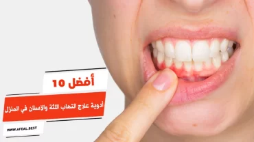 أفضل 10 أدوية علاج التهاب اللثة والأسنان في المنزل