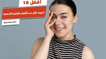 أفضل 10 أدوية علاج حب الشباب للبشرة الدهنية