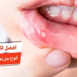 أفضل 10 أنواع جل لعلاج قروح الفم