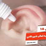أفضل 10 أنواع قطرة لعلاج طنين الأذن