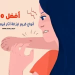 أفضل 10 أنواع كريم لازالة اثار قرص الناموس