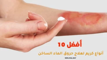 أفضل 10 أنواع كريم لعلاج حروق الماء الساخن
