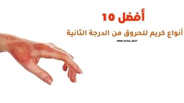 أفضل 10 أنواع كريم للحروق من الدرجة الثانية