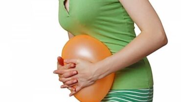 طارد للغازات